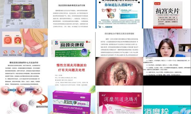 汕头治疗宫颈炎