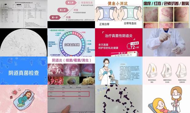 汕头妇科检查 - 汕头外阴瘙痒检查白带真菌怎么办