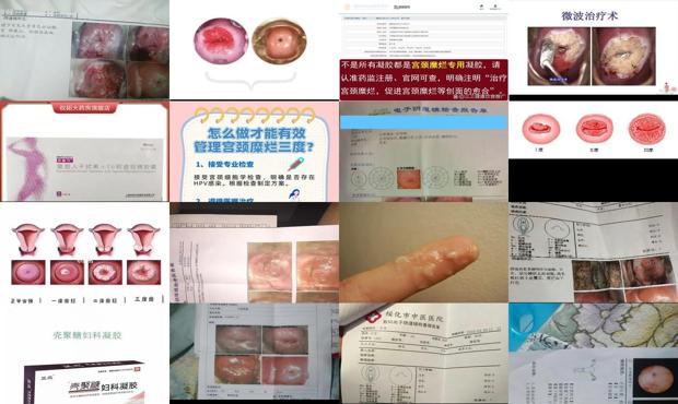 汕头那家妇科诊所好 - 汕头治疗宫颈糜烂哪个医院好