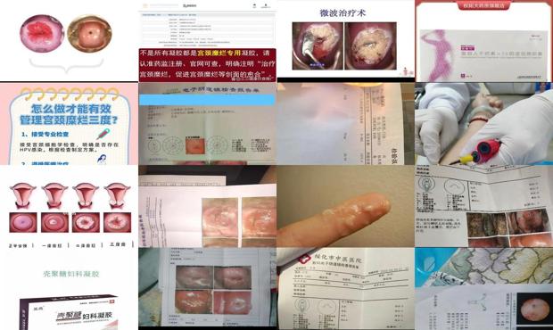 汕头中心医院验血价格 - 汕头抽血检查早孕能吃饭吗