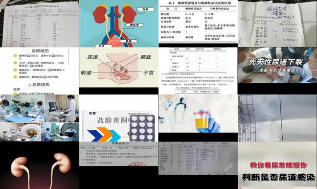 尿道感染兵检能过吗 - 汕头尿道感染检查什么