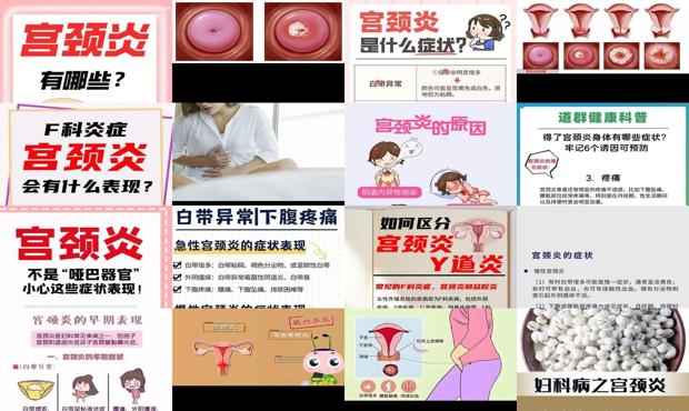 汕头宫颈炎的症状
