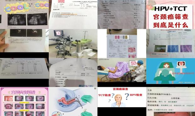 汕头宫颈常规检查