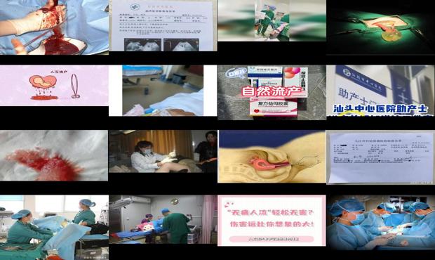 汕头*流产