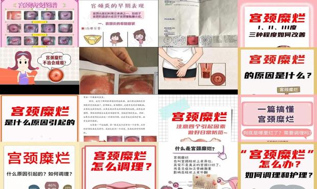 汕头宫颈糜烂怎么引起的