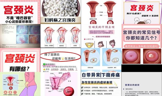汕头宫颈炎有哪些症状