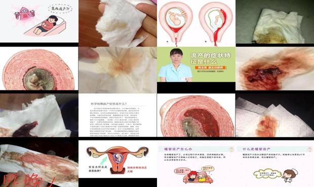 汕头流产的症状