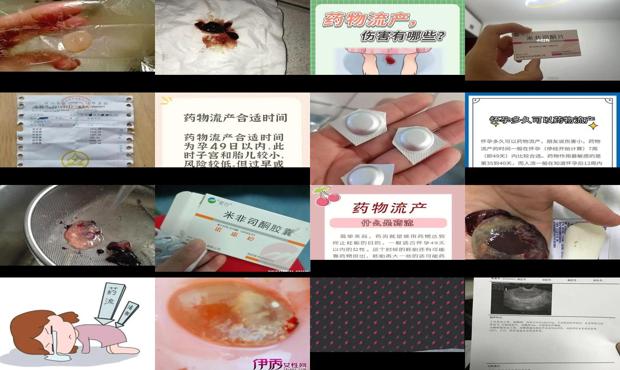 汕头做人流 - 汕头药物流产