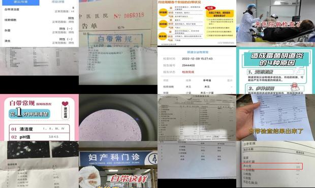 汕头月经不调,医生为什么要我检查白带真菌