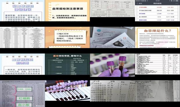 汕头做血常规检查多少钱