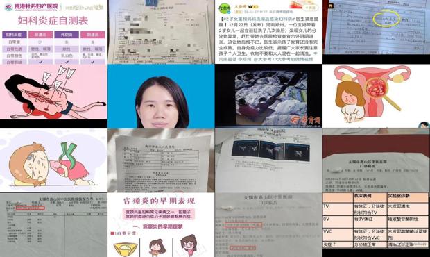 汕头外阴炎怎么检查