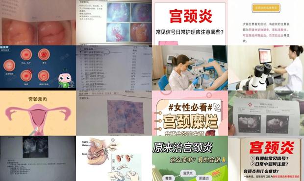 汕头怎么检查有不有宫颈炎