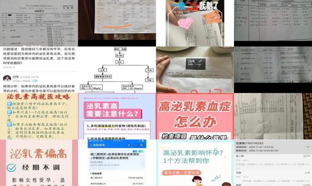 汕头泌乳素高不孕怎么办