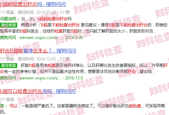 汕头肝炎b超能检查出来吗