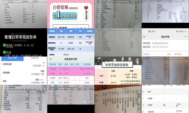 汕头正常白带常规检查指标