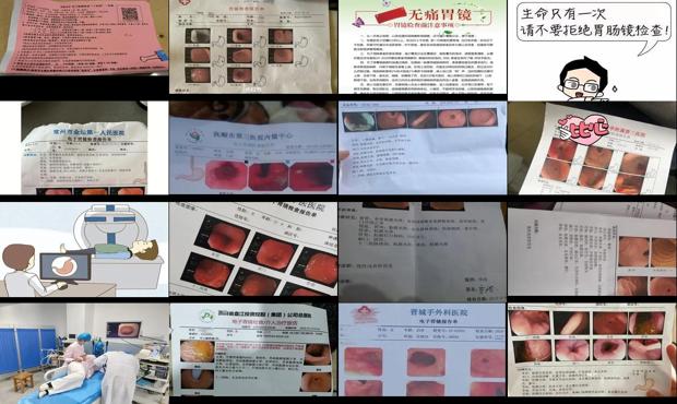 汕头做畏镜检查是否要空肚