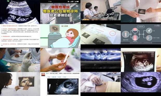 汕头24天做b超能检查出怀孕吗