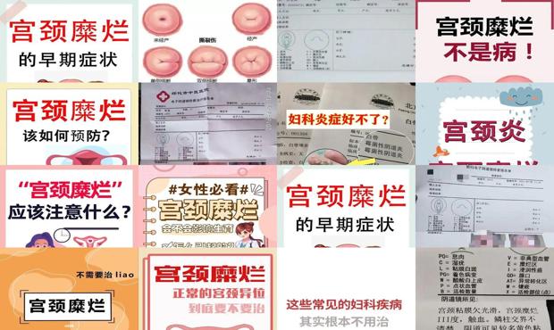汕头宫颈糜烂怎样治