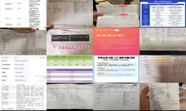 汕头月经检查要查什么项目