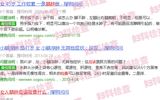 汕头女人腿肿应该检查什么