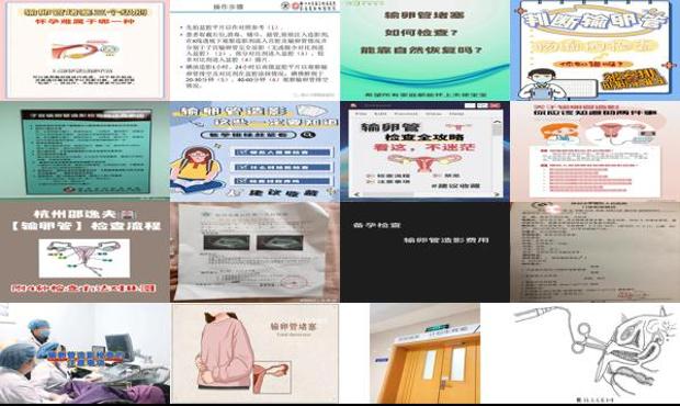 汕头中心医院查输卵管 - 汕头输卵管检查流程