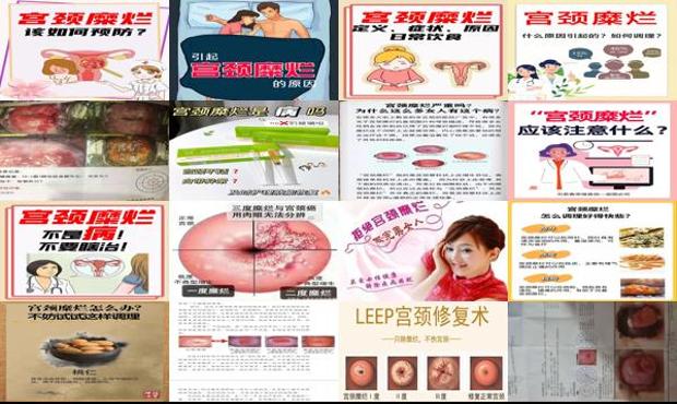 汕头宫颈糜烂怎么治