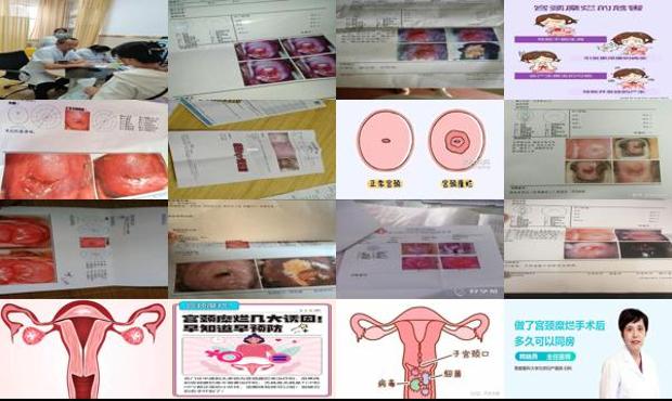 汕头宫颈糜烂可以同房吗