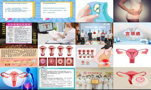汕头宫颈疾病有什么症状