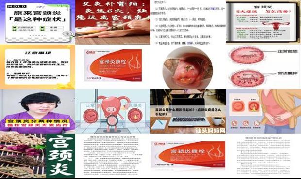 汕头宫颈炎*佳治疗方法