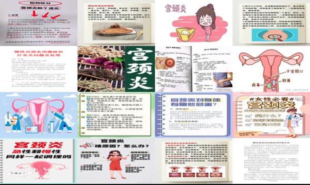 宫颈慢性炎治疗 - 汕头慢性宫颈炎的危害