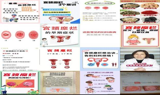 汕头宫颈糜烂怎么造成的