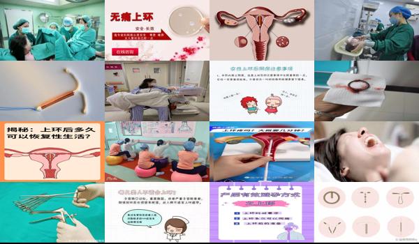 汕头上环多少钱 - 汕头分娩时上环可以吗