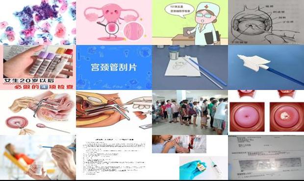 汕头宫颈刮片检查多少钱 - 汕头宫颈刮片检查
