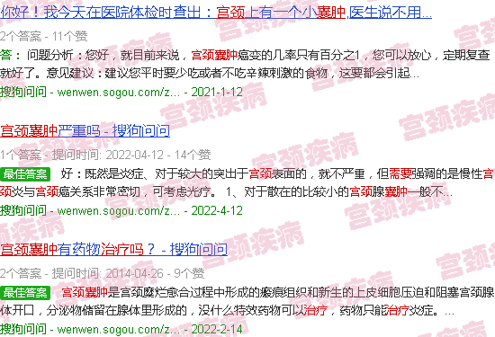 汕头宫颈*需要治疗吗