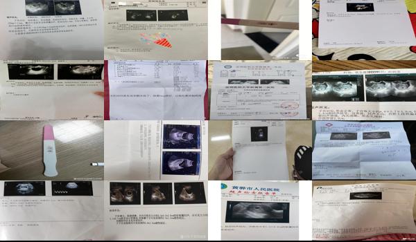 汕头怀孕一个半月检查没孕囊正常吗? - 汕头怀孕一个半月检查没孕囊
