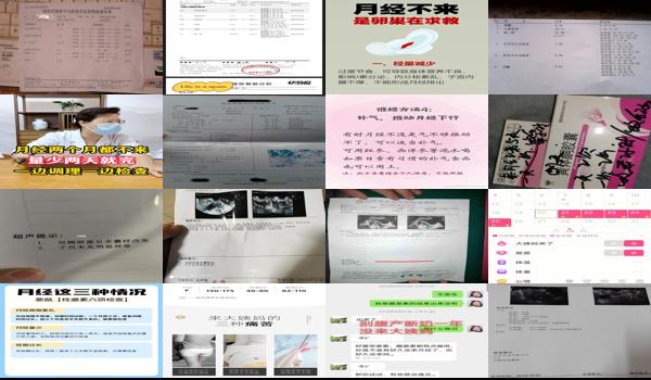 不来月经去医院检查需要多少钱 - 汕头一般不来月经检查什么