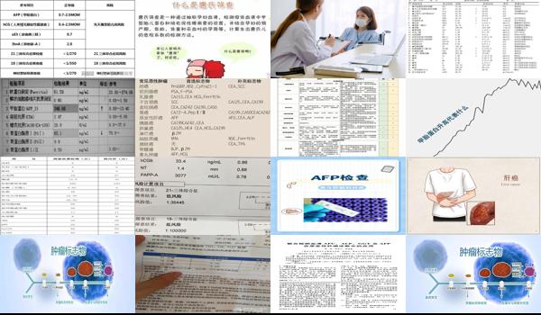 afp检查需要空腹吗? - 汕头afp检查需要空腹吗