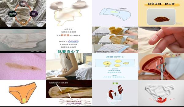 妇科炎症会有褐色分泌物带血吗 - 汕头妇科炎症会有咖啡色分泌物吗