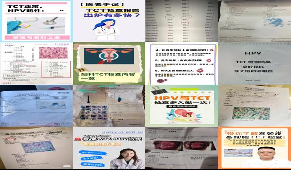 tct检查可靠吗 - 汕头tct检查是什么