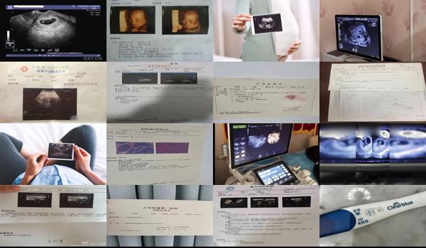 汕头怀孕四个月b超检查多少钱 - 汕头怀孕四个月b超检查