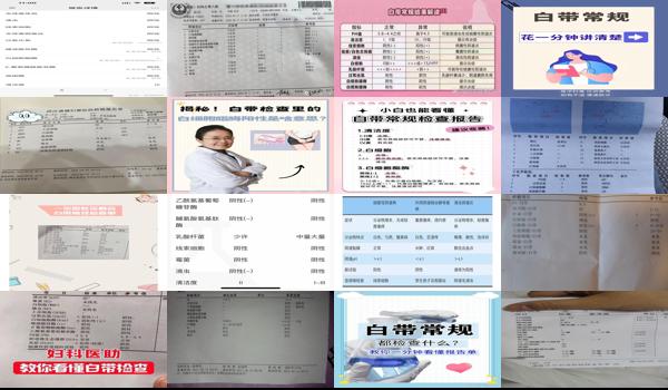 汕头妇科检查多少钱 - 汕头做白带常规检查多久能出结果