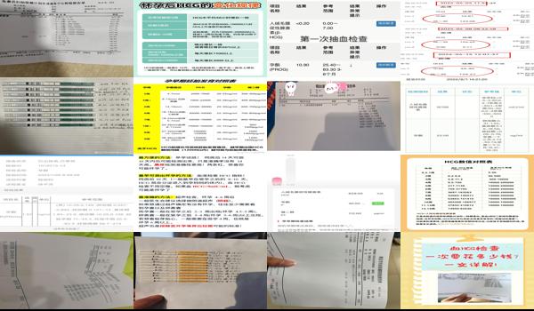 汕头哪里可以验血查男女 - 汕头血hcg主要检查什么