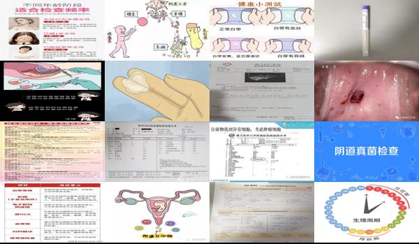 怀孕八个月用作分泌物检查吗 - 汕头孕8个月做阴道分泌物检查