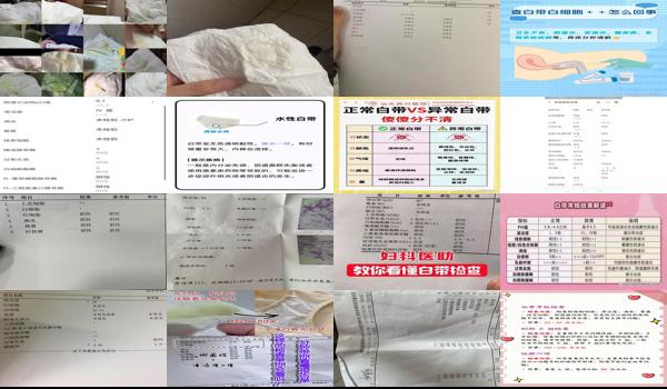 汕头哪里检查妇科比较好 - 汕头白带常规检查是查什么