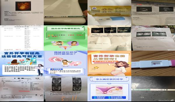怀孕40天可以检查出宫外孕吗 - 汕头怀孕四十天一定能检查出宫外怀孕